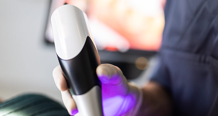 Intraoralscanner